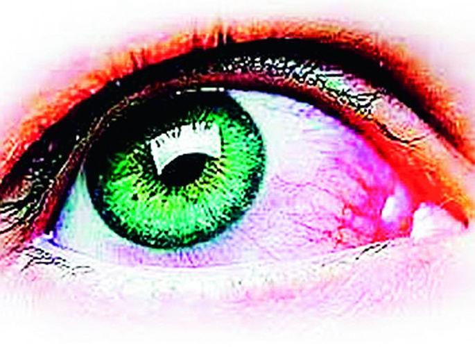 194 patients with mucormycosis | म्युकरमायकोसिसचे 194 रुग्ण 194 patients with mucormycosis | म्युकरमायकोसिसचे 194 रुग्ण