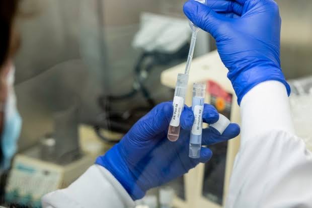 Coronavirus Pune: Beware ... if you argue, you will get a 'positive' report; Types in Warje Malwadi | Coronavirus Pune : सावधान...वाद घालाल तर तुमचा येईल ‘पॉझिटिव्ह’ रिपोर्ट; वारजे माळवाडीतील प्रकार Coronavirus Pune: Beware ... if you argue, you will get a 'positive' report; Types in Warje Malwadi | Coronavirus Pune : सावधान...वाद घालाल तर तुमचा येईल ‘पॉझिटिव्ह’ रिपोर्ट; वारजे माळवाडीतील प्रकार