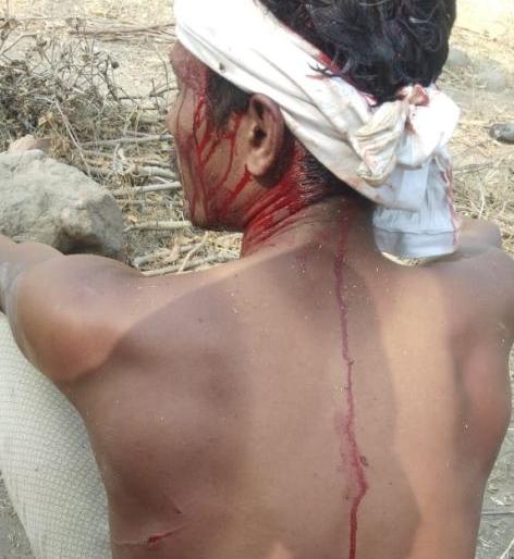 Tiger attacks three youths in Yavatmal district | यवतमाळ जिल्ह्यात वाघाचा तीन युवकांवर हल्ला