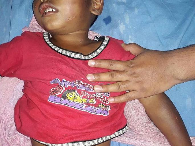 nashik,child,father,molestation | जन्मदात्यानेच दिले साडेतीन वर्षांच्या चिमुकल्यास चटके़... nashik,child,father,molestation | जन्मदात्यानेच दिले साडेतीन वर्षांच्या चिमुकल्यास चटके़...