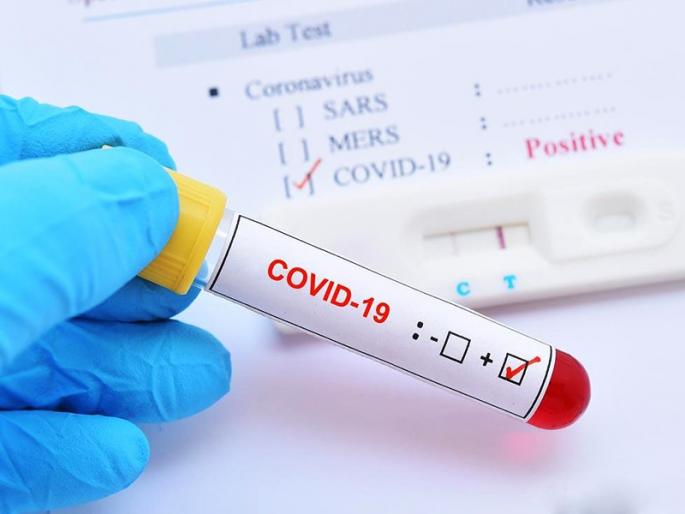 Estimates of Solapur Municipal Corporation; Twenty people were infected with corona in a hundred trials | सोलापूर महापालिकेचा अनुमान; शंभर चाचणीत वीस जणांना कोरोनाची लागण Estimates of Solapur Municipal Corporation; Twenty people were infected with corona in a hundred trials | सोलापूर महापालिकेचा अनुमान; शंभर चाचणीत वीस जणांना कोरोनाची लागण