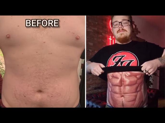 Man made a six pack in two days with this unique jugaad | Gym मध्ये घाम गाळूनही बनली नाही बॉडी तर जुगाड करून दोन दिवसात मिळवले Six Pack Man made a six pack in two days with this unique jugaad | Gym मध्ये घाम गाळूनही बनली नाही बॉडी तर जुगाड करून दोन दिवसात मिळवले Six Pack