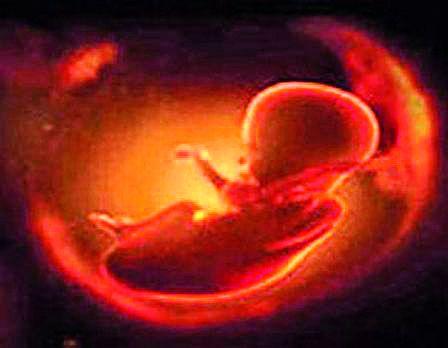 2763 abortions in the district in two and a half years | जिल्ह्यात अडीच वर्षांत २७६३ गर्भपात 2763 abortions in the district in two and a half years | जिल्ह्यात अडीच वर्षांत २७६३ गर्भपात