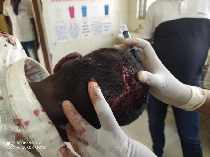 Civilians injured in leopard attack | बिबट्याच्या हल्ल्यात नागरिक जखमी