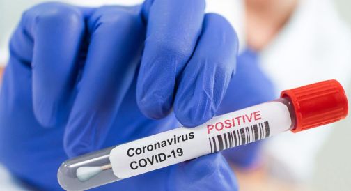 Both died of corona | नंदुरबार जिल्ह्यात कोरोनामुळे दोघांचा मृत्यू Both died of corona | नंदुरबार जिल्ह्यात कोरोनामुळे दोघांचा मृत्यू