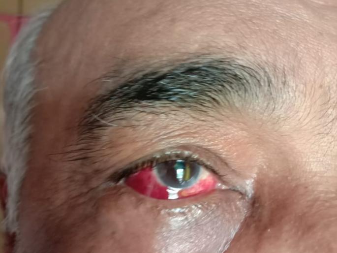 Retired naval officer assault case: Five Shiv Sainiks arrested in Kandivali in 'infiltration' case | निवृत्त नौदल अधिकारी मारहाण प्रकरण : कांदिवलीत पाच शिवसैनिकांना 'घुसखोरी' प्रकरणी अटक Retired naval officer assault case: Five Shiv Sainiks arrested in Kandivali in 'infiltration' case | निवृत्त नौदल अधिकारी मारहाण प्रकरण : कांदिवलीत पाच शिवसैनिकांना 'घुसखोरी' प्रकरणी अटक