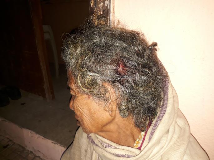 The leopard attacks the old man in Watar | वटारला बिबट्याचा वृद्धेवर हल्ला The leopard attacks the old man in Watar | वटारला बिबट्याचा वृद्धेवर हल्ला