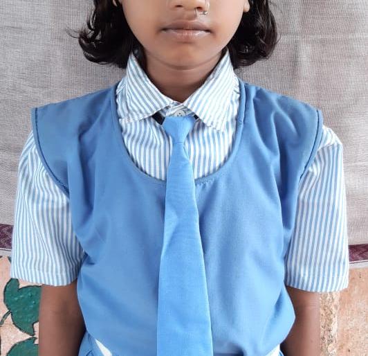 Schoolgirl dies of snake bite | शालेय विद्यार्थीनीचा सर्पदंशाने मृत्यू Schoolgirl dies of snake bite | शालेय विद्यार्थीनीचा सर्पदंशाने मृत्यू