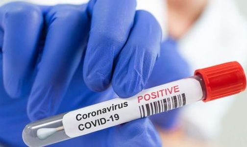 Corona crosses 300 in the district | जिल्ह्यात ‘कोरोना’ ३०० च्या पार Corona crosses 300 in the district | जिल्ह्यात ‘कोरोना’ ३०० च्या पार