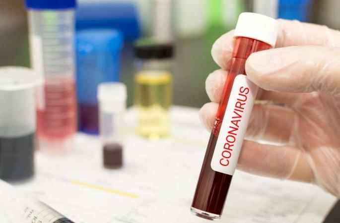 16 positives throughout the day; 15 people defeated Corona | दिवसभरात १६ पॉझिटिव्ह; १५ जणांची कोरोनावर मात 16 positives throughout the day; 15 people defeated Corona | दिवसभरात १६ पॉझिटिव्ह; १५ जणांची कोरोनावर मात