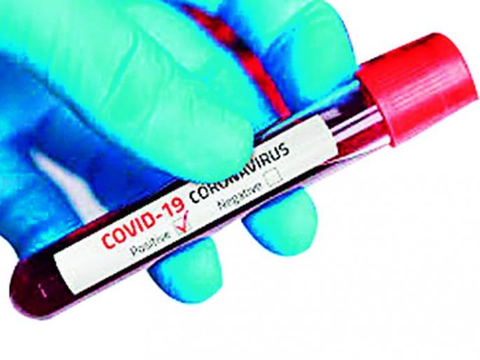 The percentage of corona positive patients increased | कोरोना पॉझिटिव्ह रुग्णांचा टक्का वाढला