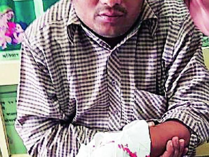 Government office | शासकीय कार्यालयातील परिचराला चावा Government office | शासकीय कार्यालयातील परिचराला चावा