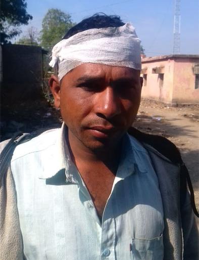 Refusal to give girl; Uncle"s head broke! | मुलगी देण्यास नकार; मामाचे डोके फोडले !