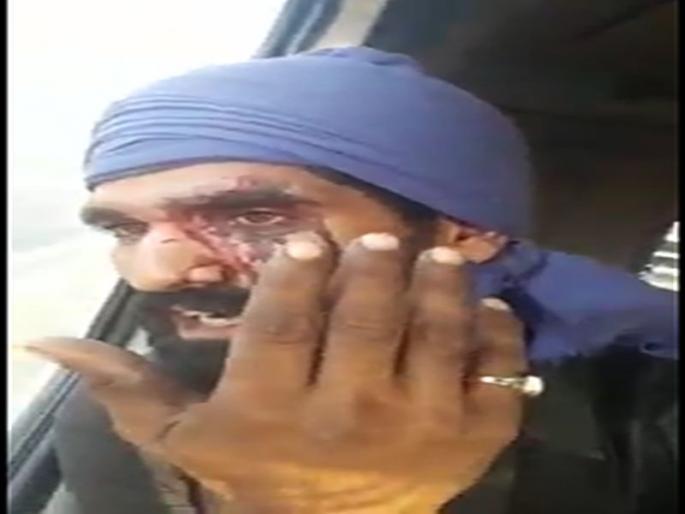 Due to not paying two hundred rupees entry fee, the head of the container driver broke | दोनशे रुपये एन्ट्री फी न दिल्याने कंटेनर चालकाचे डोके फोडले Due to not paying two hundred rupees entry fee, the head of the container driver broke | दोनशे रुपये एन्ट्री फी न दिल्याने कंटेनर चालकाचे डोके फोडले