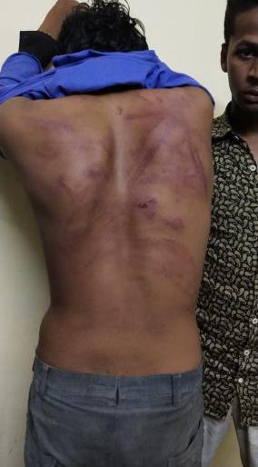  Jamner drops the youth drunkenly | जामनेरला तरुणास बेदम मारहाण