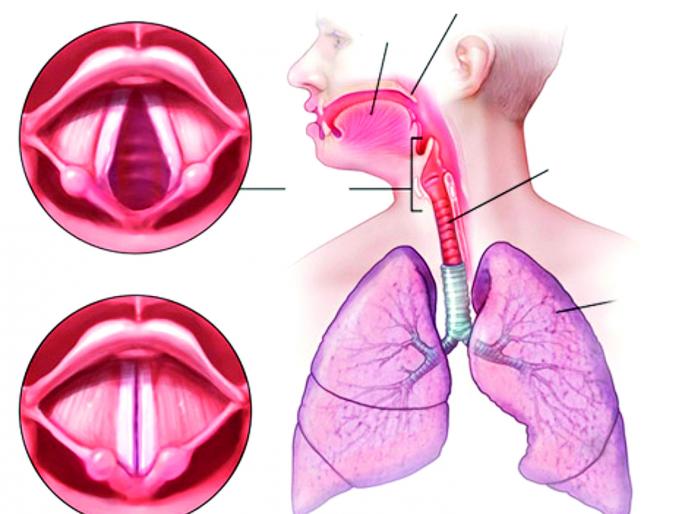 Express it to the other person, but take care of it as well as the medium of voice, the larynx | दुसऱ्यासमोर व्यक्त व्हा, पण आवाजाचे माध्यम, स्वरयंत्र याचीही तितकीच काळजी घ्या Express it to the other person, but take care of it as well as the medium of voice, the larynx | दुसऱ्यासमोर व्यक्त व्हा, पण आवाजाचे माध्यम, स्वरयंत्र याचीही तितकीच काळजी घ्या