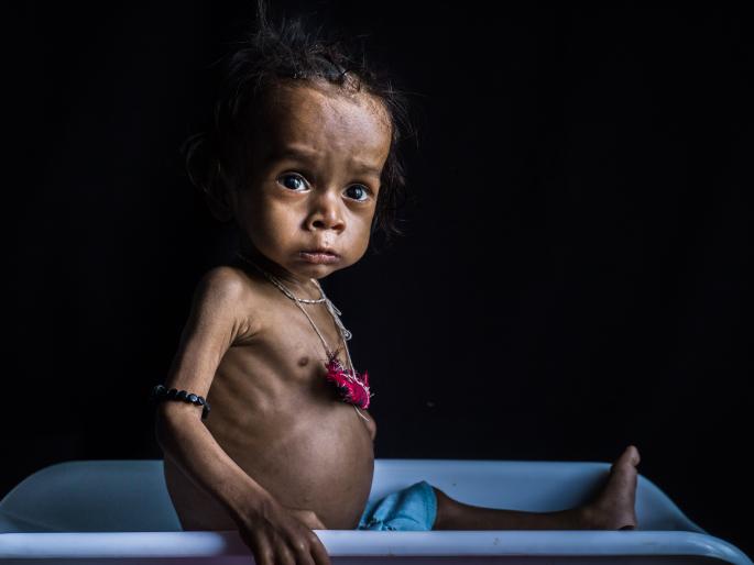 Child mortality in the state is not due to malnutrition; Women and Child Development Minister Pankaja Munde | राज्यातील बालमृत्यू कुपोषणामुळे नाहीच; महिला व बालविकास मंत्री पंकजा मुंडे यांची माहिती