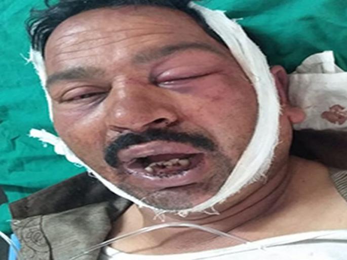 Both attack on father-level | बाप-लेकावर दोघांचा हल्ला Both attack on father-level | बाप-लेकावर दोघांचा हल्ला