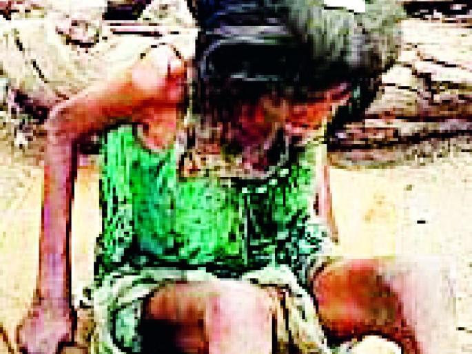 Father gets life for the second time | पपिताला मिळाले दुसऱ्यांदा जीवनदान Father gets life for the second time | पपिताला मिळाले दुसऱ्यांदा जीवनदान