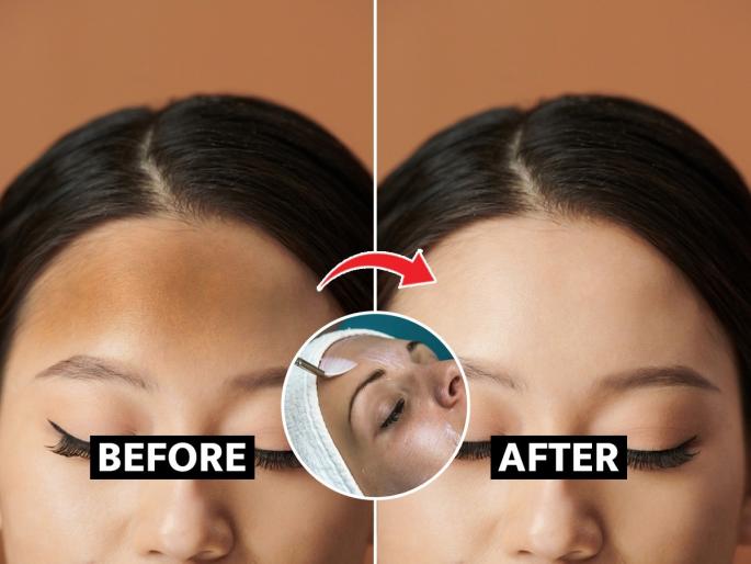 2 home remedies to reduce tanning and dead skin from forehead, how to get rid of pigmentation on forehead | गोरेगोरे गाल पण कपाळावर मात्र काळेकाळे थर? २ घरगुती उपाय-कपाळावरचं टॅनिंग होईल कमी