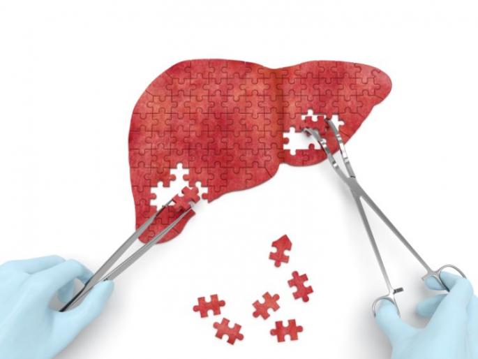 For the first time in Nagpur, liver transplant is successful | नागपुरात प्रथमच यकृत प्रत्यारोपण यशस्वी For the first time in Nagpur, liver transplant is successful | नागपुरात प्रथमच यकृत प्रत्यारोपण यशस्वी