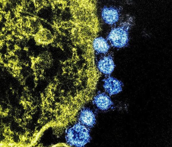 Three positive in Bhandara district | Corona Virus in Bhandara; भंडारा जिल्हयात तीन जण पॉझिटिव्ह