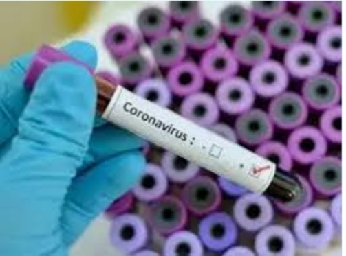 Three nurses, a brother and a cleaner from Solapur also contracted corona | सोलापुरातील तीन नर्स, ब्रदर, सफाई कर्मचाºयालाही कोरोनाची लागण Three nurses, a brother and a cleaner from Solapur also contracted corona | सोलापुरातील तीन नर्स, ब्रदर, सफाई कर्मचाºयालाही कोरोनाची लागण