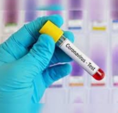 9 positive in Solapur and 67 negative in rural areas ...! | सोलापुरात ९ पॉझीटिव्ह तर ग्रामीणमधील ६७ 'कोरोना' बाधित निगेटिव्ह...! 9 positive in Solapur and 67 negative in rural areas ...! | सोलापुरात ९ पॉझीटिव्ह तर ग्रामीणमधील ६७ 'कोरोना' बाधित निगेटिव्ह...!