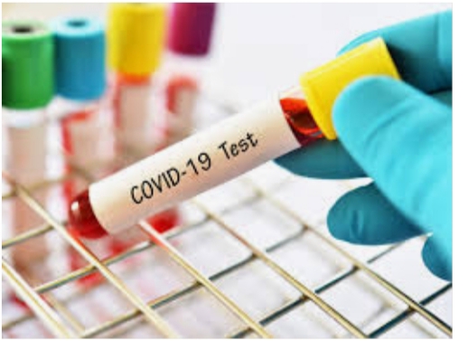 Ranjit Singh's wife's corona report negative! | रणजितसिंहांसह त्यांच्या पत्नीचा कोरोना अहवाल निगेटिव्ह ! Ranjit Singh's wife's corona report negative! | रणजितसिंहांसह त्यांच्या पत्नीचा कोरोना अहवाल निगेटिव्ह !