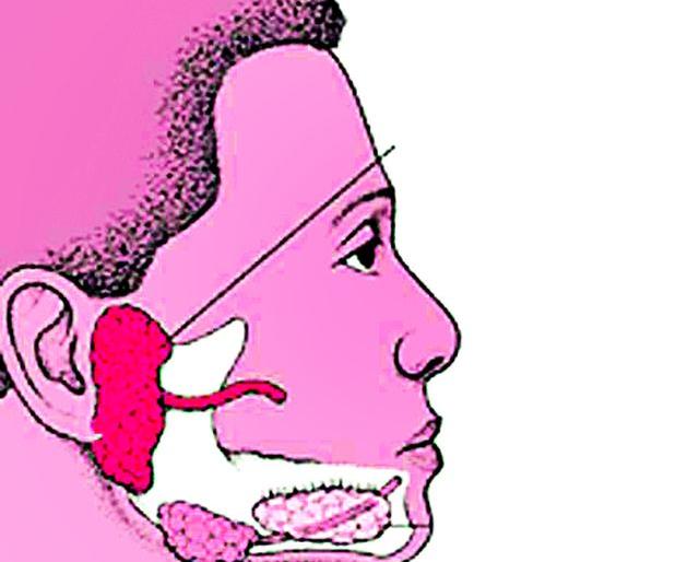 'Galfugi' illness found | ‘गालफुगी’ आजाराचे रु ग्ण आढळले 'Galfugi' illness found | ‘गालफुगी’ आजाराचे रु ग्ण आढळले