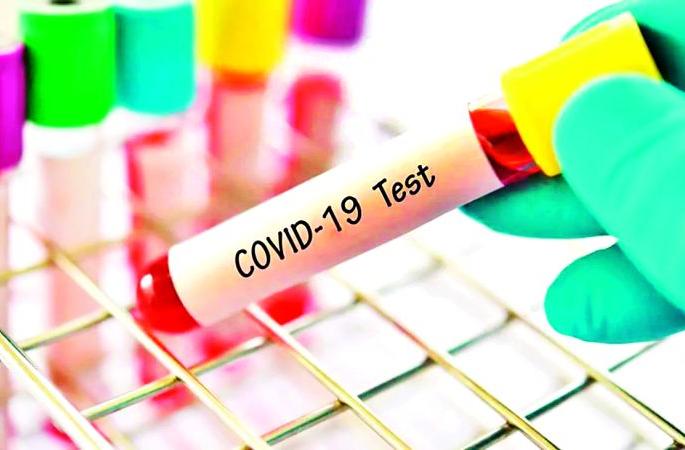 12,756 teachers will be tested | 12,756 शिक्षकांची हाेणार काेराेना चाचणी