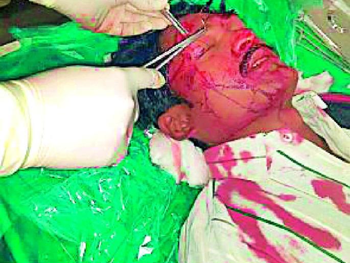 A deadly attack on a cleaner employee | स्वच्छता कर्मचाऱ्यावर प्राणघातक हल्ला A deadly attack on a cleaner employee | स्वच्छता कर्मचाऱ्यावर प्राणघातक हल्ला