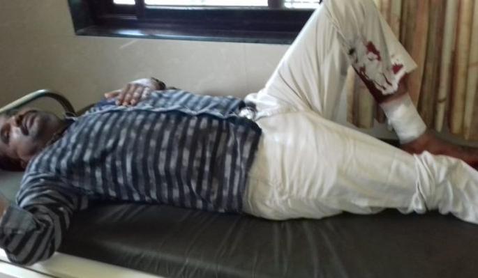 Four people were injured when a gunman opened fire on a security guard at Varangaon | वरणगाव येथे सुरक्षा रक्षकाकडून बंदुकीची गोळी सुटल्याने चार जखमी Four people were injured when a gunman opened fire on a security guard at Varangaon | वरणगाव येथे सुरक्षा रक्षकाकडून बंदुकीची गोळी सुटल्याने चार जखमी