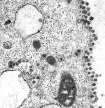 Coronavirus News: Coronavirus infects 11 policemen including Rdon officers: Police constable dies | Coronavirus News: ्र्र्दोन अधिकाऱ्यांसह ११ पोलिसांना कोरोनाची लागण: पोलीस हवालदाराचा मृत्यु