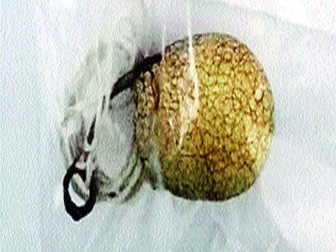  Cracking fraud: Economic bait lure | नागमणी भासवून फसवणूक : आर्थिक भरभराटीचे आमिष