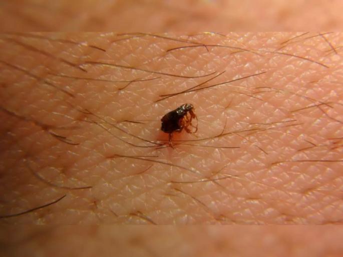 Be careful! Returning scrub typhus | सावधान! परत येतोय स्क्रब टायफस Be careful! Returning scrub typhus | सावधान! परत येतोय स्क्रब टायफस