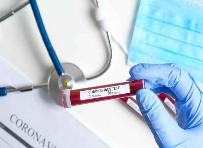 The health of the positive patients in Nagpur is improving | नागपुरातील पॉझिटिव्ह रुग्णांची प्रकृती सुधारतेय