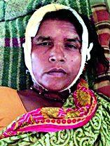 Gunda's assault on Kurundi woman | गुंडाचा महिलेवर कुऱ्हाडीने हल्ला Gunda's assault on Kurundi woman | गुंडाचा महिलेवर कुऱ्हाडीने हल्ला