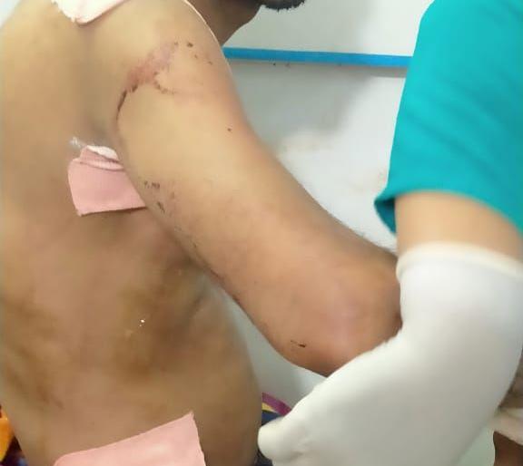 Knife attack on suspicion of informing illegal trades | अवैध धंद्यांची माहिती दिल्याच्या संशयावरून चाकू हल्ला Knife attack on suspicion of informing illegal trades | अवैध धंद्यांची माहिती दिल्याच्या संशयावरून चाकू हल्ला