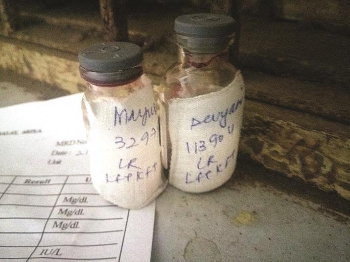 Blood samples in Akola 'GMC' keep irresponsibly | अकोला ‘जीएमसी’त रक्ताचे नमुने बेवारस Blood samples in Akola 'GMC' keep irresponsibly | अकोला ‘जीएमसी’त रक्ताचे नमुने बेवारस