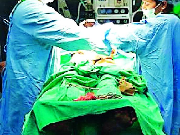 Inverted 9 5 successful surgery | अहेरीत ९५ यशस्वी शस्त्रक्रिया