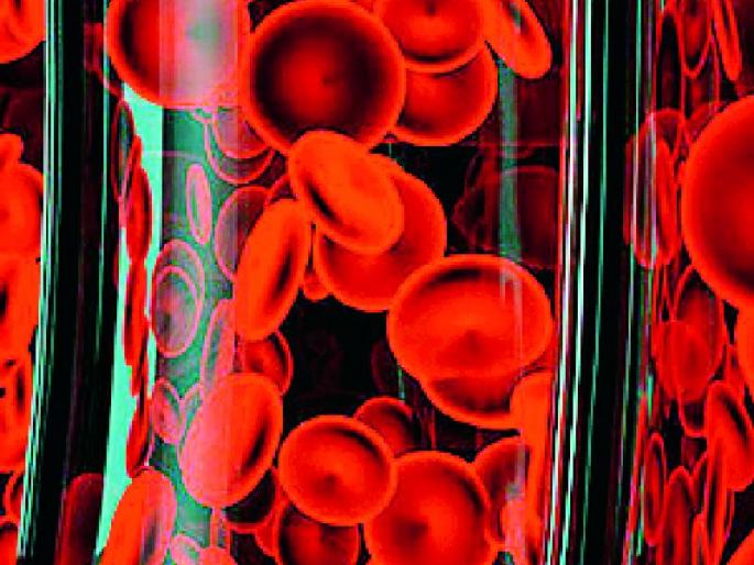 Gondia leprosy rate higher than the state | राज्यापेक्षा गोंदियाचा कुष्ठरोग दर अधिक Gondia leprosy rate higher than the state | राज्यापेक्षा गोंदियाचा कुष्ठरोग दर अधिक