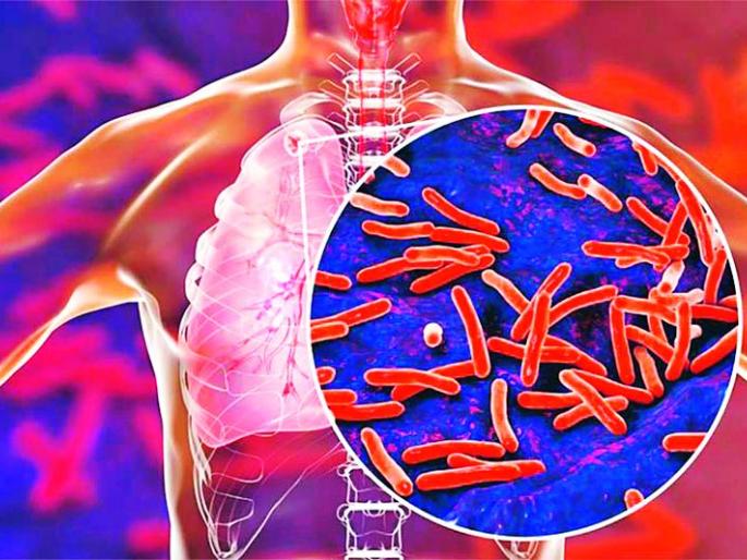 Kovid-19 virus defeated by 36 HIV positive people in the district | जिल्ह्यातील ३६ एचआयव्हीसह टीबी ग्रस्तांनी हरविले कोविड-१९ विषाणूला