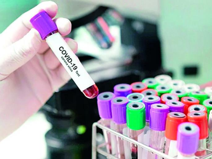 Responsibility for the health of the citizens in a district with low manpower | अल्प मनुष्यबळ सांभाळतेय जिल्ह्यात नागरिकांच्या आरोग्याची जबाबदारी Responsibility for the health of the citizens in a district with low manpower | अल्प मनुष्यबळ सांभाळतेय जिल्ह्यात नागरिकांच्या आरोग्याची जबाबदारी