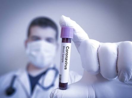 Corona virus: 987 new corona infections in Pimpri on Saturday; 18 died | Corona virus : पिंपरीत शनिवारी ९८७ नवे कोरोनाबाधित; १८ जणांचा बळी Corona virus: 987 new corona infections in Pimpri on Saturday; 18 died | Corona virus : पिंपरीत शनिवारी ९८७ नवे कोरोनाबाधित; १८ जणांचा बळी