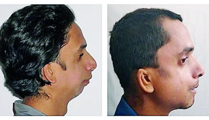 He was not asleep for 30 years ... | 'तो' तब्बल ३० वर्षांनंतर झोपला अन् आईने पेढेच वाटले! He was not asleep for 30 years ... | 'तो' तब्बल ३० वर्षांनंतर झोपला अन् आईने पेढेच वाटले!