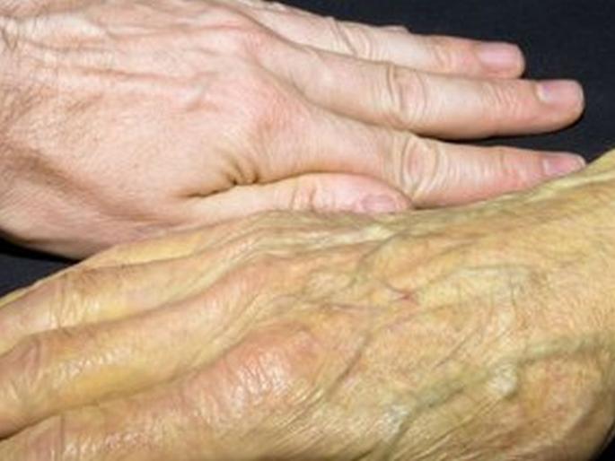 Six victims of jaundice disease in Nagpur | उपराजधानीत काविळसदृश आजाराचे सहा बळी Six victims of jaundice disease in Nagpur | उपराजधानीत काविळसदृश आजाराचे सहा बळी