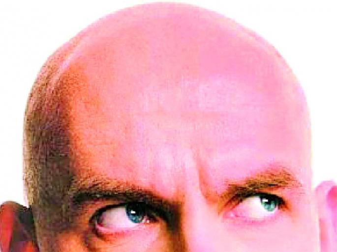 Citizens prefer baldness during lockdown | लॉकडाऊनच्या काळात नागरिकांची टक्कलला पसंती Citizens prefer baldness during lockdown | लॉकडाऊनच्या काळात नागरिकांची टक्कलला पसंती