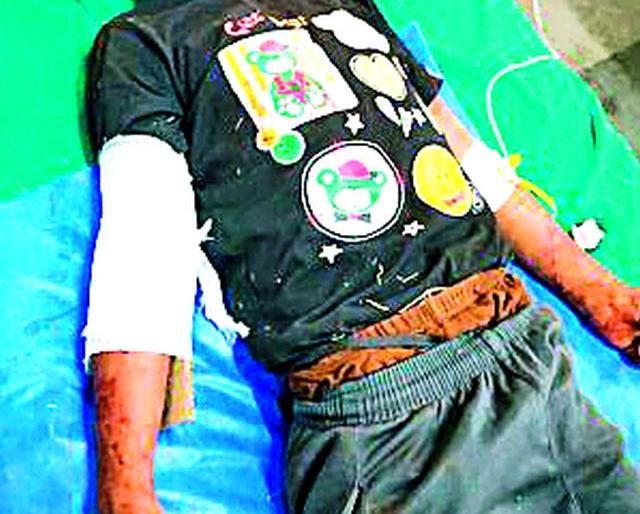 With sharp weapons attacked the child | बालकावर धारदार शस्त्राने हल्ला With sharp weapons attacked the child | बालकावर धारदार शस्त्राने हल्ला