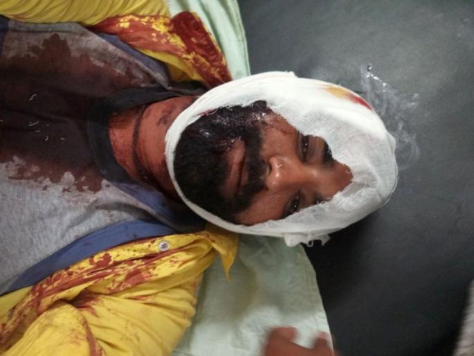 Elections in Dhule, sword attack, tension situation | धुळ्यात निवडणूक वादातून तलवार हल्ला, तणावाची स्थिती Elections in Dhule, sword attack, tension situation | धुळ्यात निवडणूक वादातून तलवार हल्ला, तणावाची स्थिती